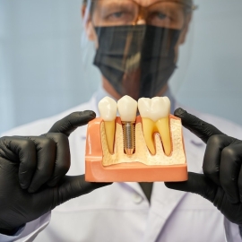 Top Dental Implants in Lakewood, California for a Natural Look
