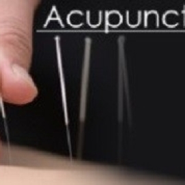 How Acupuncture for Headache in Morristown Helps You Live Pain