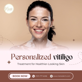 Expert vitiligo treatment for lasting results