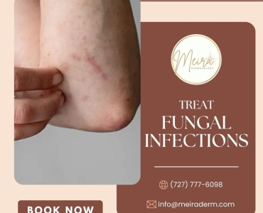 Don’t Ignore That Itch: Could It Be a Fungal Infection?