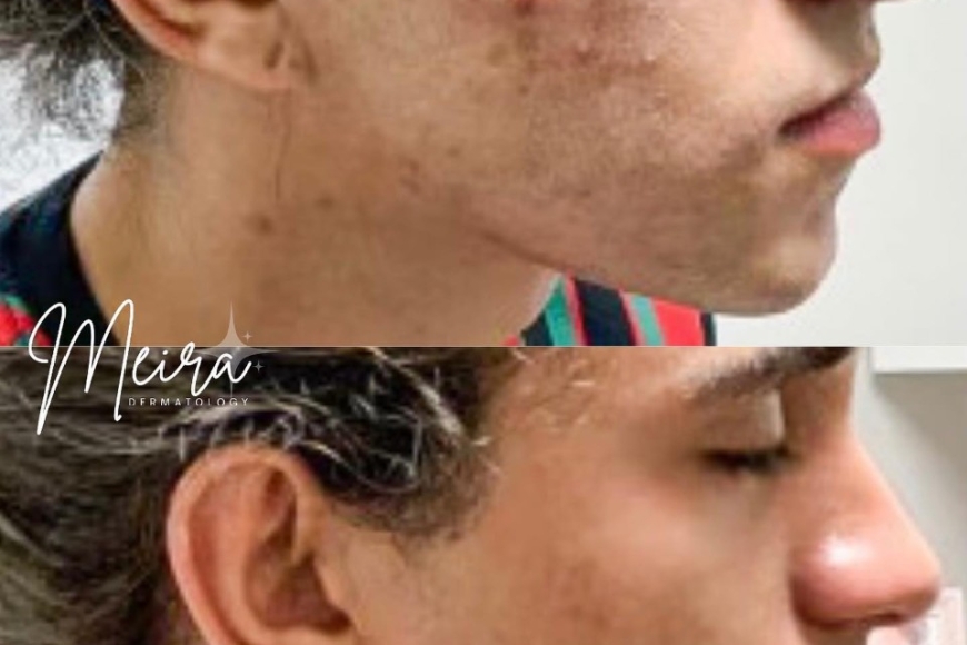 504610922_1313061200820358_96209230746220838_n