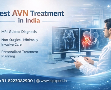 Best AVN Treatment in India -  HipXpert