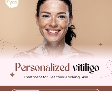Expert vitiligo treatment for lasting results